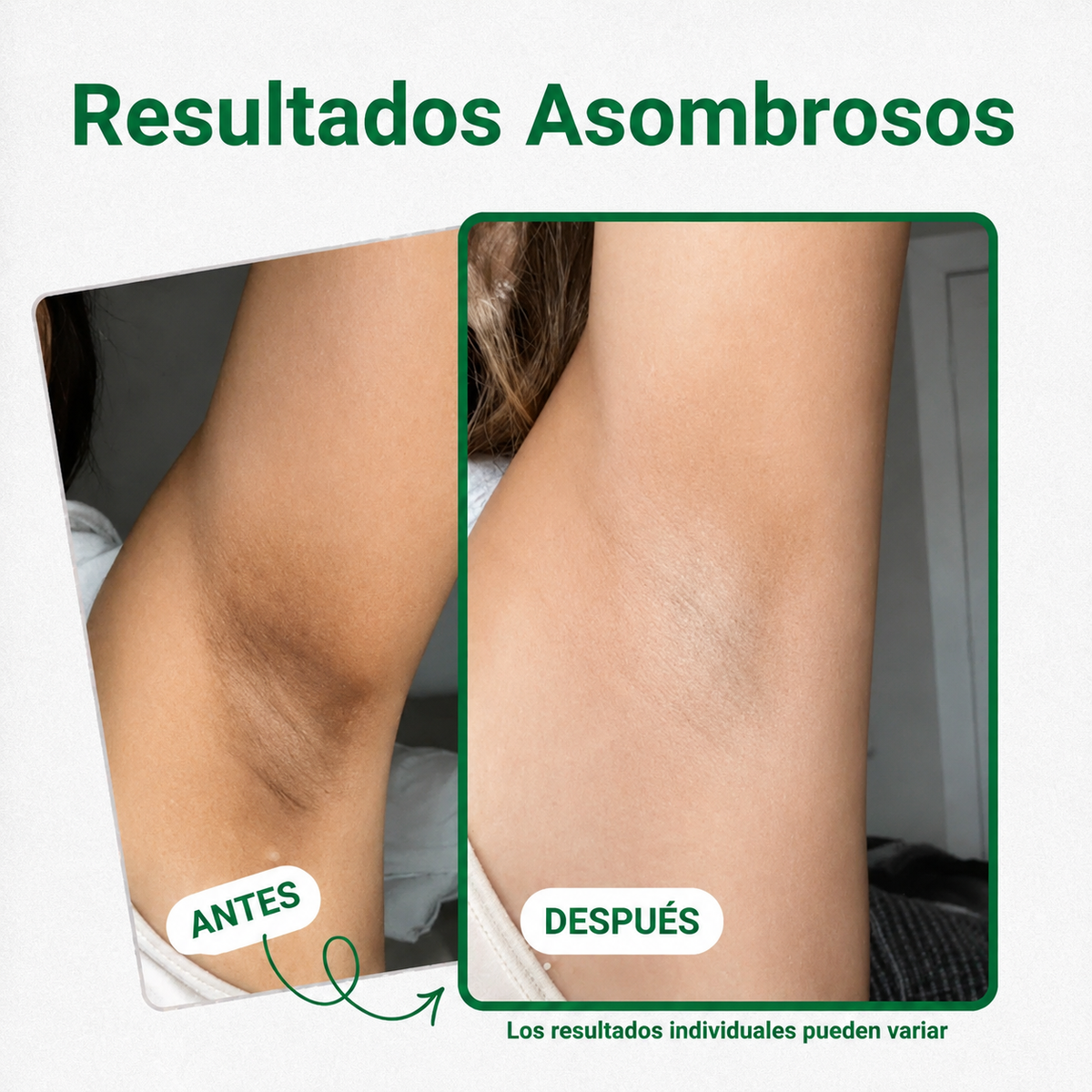 Lunea™ Parches Despigmentantes y Aclarantes